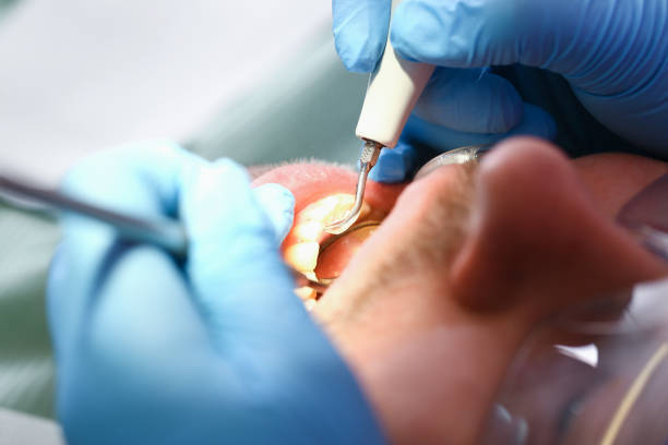 Best Emergency Cosmetic Dentistry in Fairmount, IN