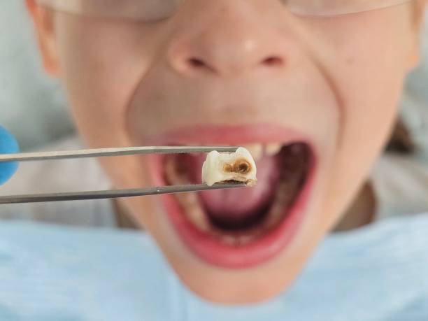 Best Weekend Emergency Dentist in Fairmount, IN
