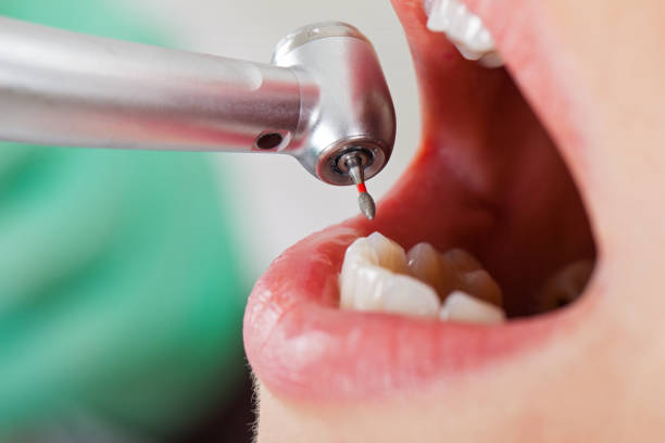 Best Urgent Dental Care for Toothache in Fairmount, IN
